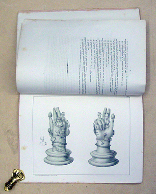 Die Votivhand