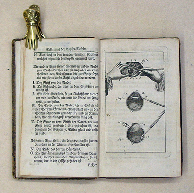 Abhandlung Von dem Grauen Stahr Und dem Glaucoma Oder Grünen Stahr, Durch den Herrn Brisseau den Jüngeren [...]. Aus dem Französischen ins Deutsche übersetzt von Johann Caspar Sommer