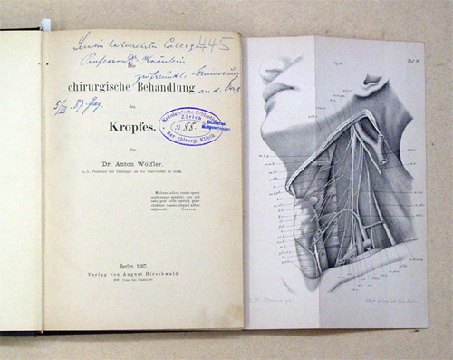 Die chirurgische Behandlung des Kropfes