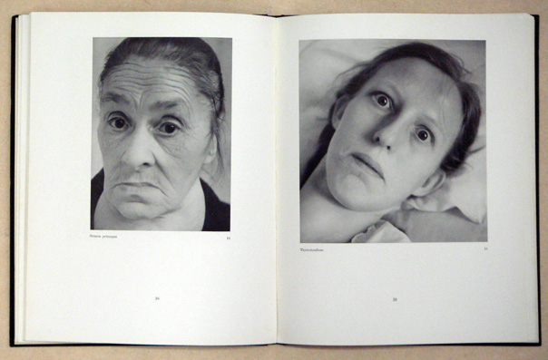 Facies dolorosa