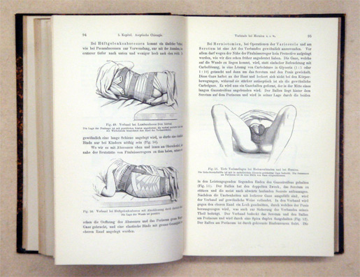 Die antiseptische Chirurgie