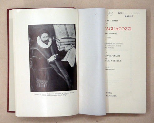 The Life and Times of Gaspare Tagliacozzi, Surgeon of Bologna, 1545 - 1599