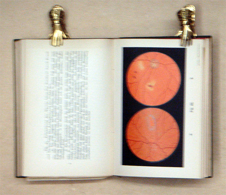 Atlas und Grundriss der Ophtalmoskopie und ophtalmoskopischen Diagnostik