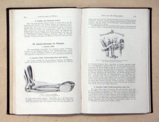 Lehrbuch der Funktionellen Behandlung der Knochenbrüche und Gelenkverletzungen