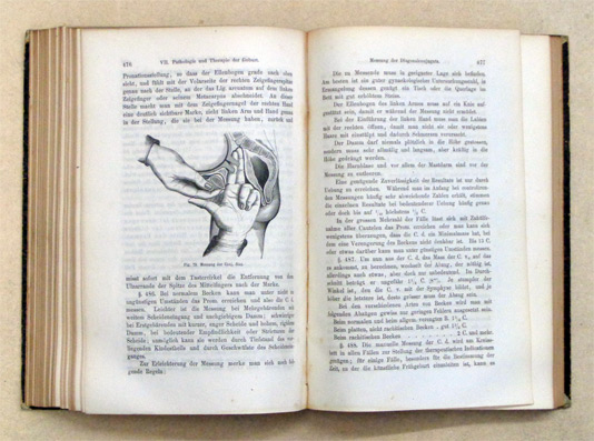 Lehrbuch der Geburtshülfe mit Einschluss der Pathologie der Schwangerschaft und des Wochenbettes