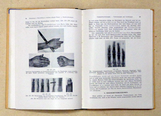 Die verletzte Hand