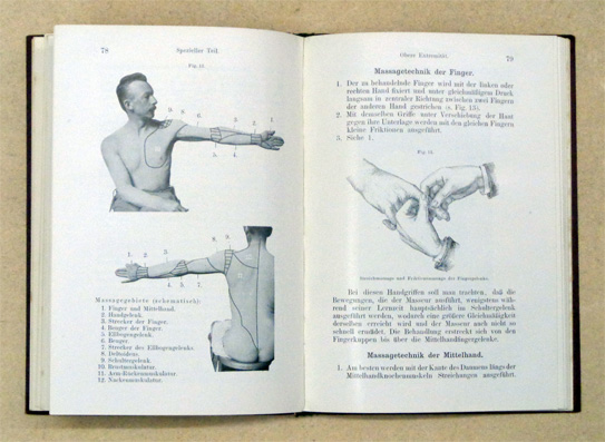 Kriegsmechanotherapie