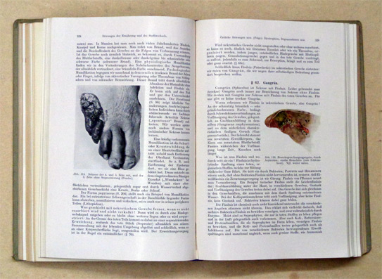 Allgemeine Pathologie